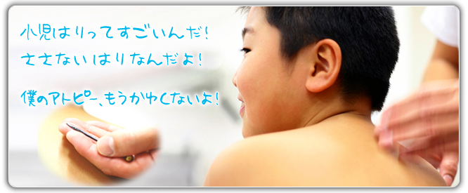 小児はり アトピー